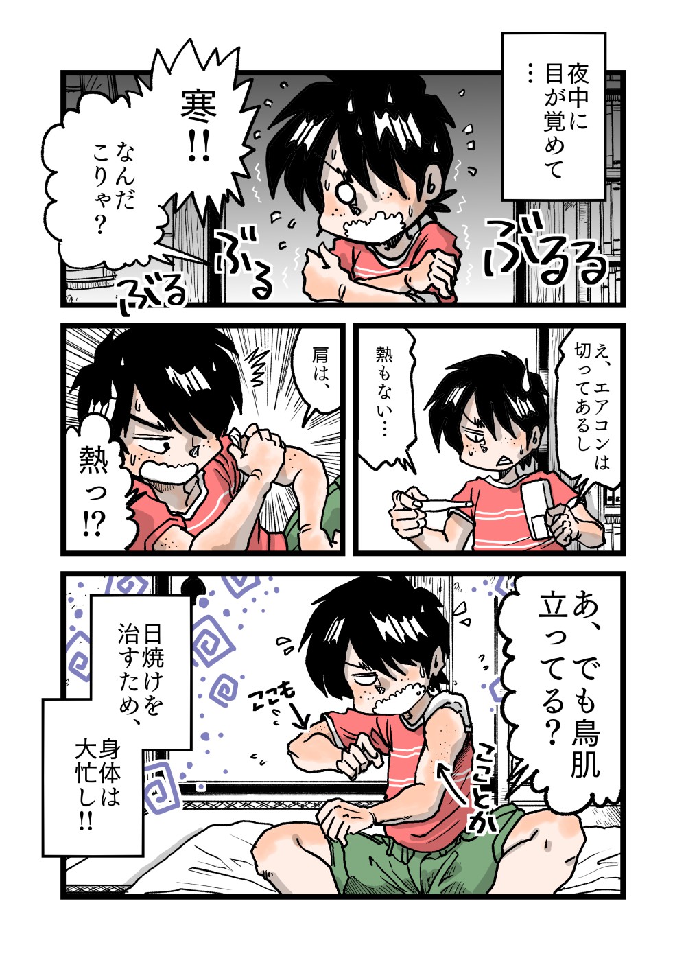 その233　日焼けで驚いた、身体の回復力！